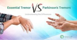 Difference Between Parkinson’s and Essential Tremors essential