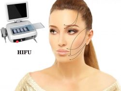 Portable HIFU machine high intensity focused ultrasound ultherapy face
