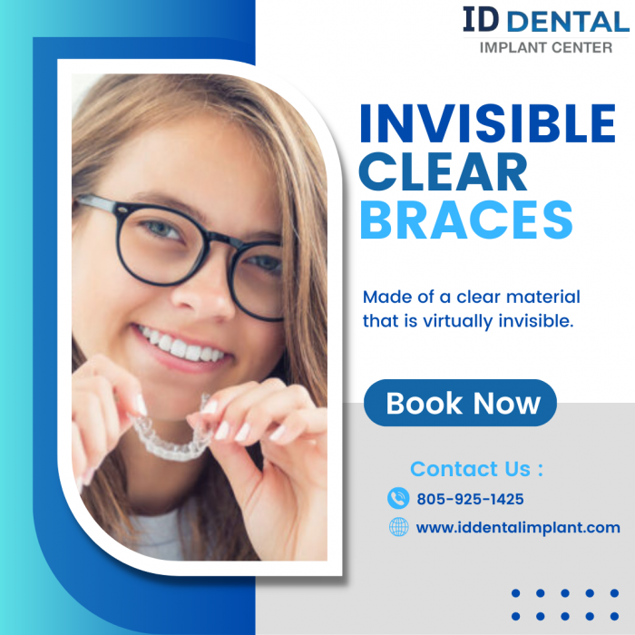 Invisible Braces Orthodontist in Los Angeles – ID Dental and Implant Center