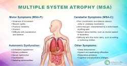 Multiple System Atrophy (MSA)