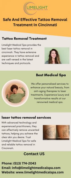 Safe And Effective Tattoo Removal Treatment In Cincinnati