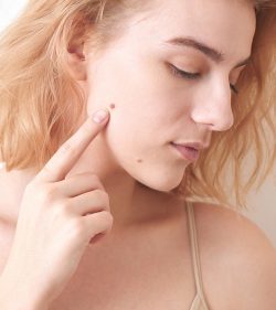 Exclusive Skin Tag Remover Avoid Risk Warnings