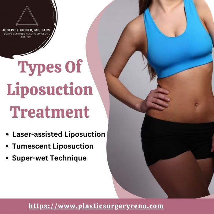Types Of Liposuction Treatment