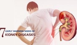 Stem Cell Therapy for Kidney Diseases