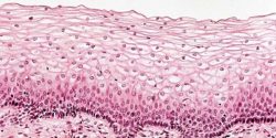 Epithelial and Endothelial Other Differences