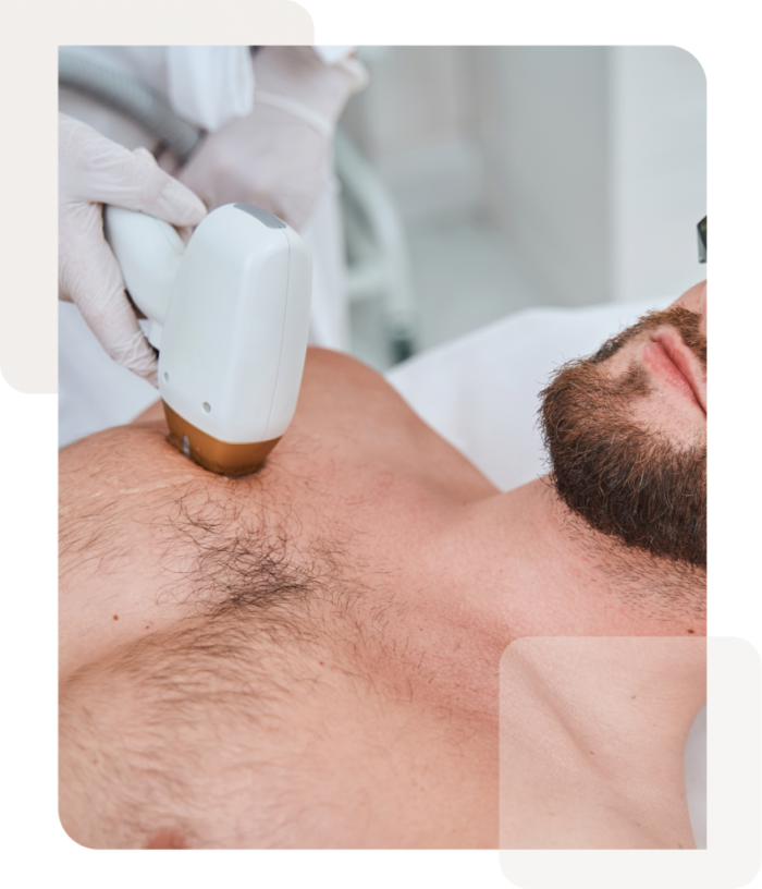 Effective Hair Removal with 808nm Diode Laser