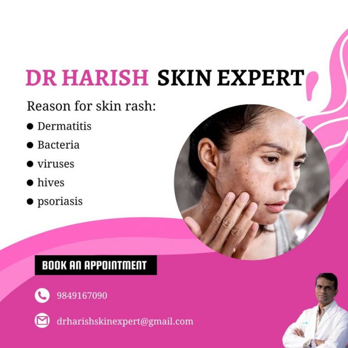DR HARISH Skin Expert | Skin And Hair Clinic | Skin Specialist in Hyderabad | Best Dermatologist ...