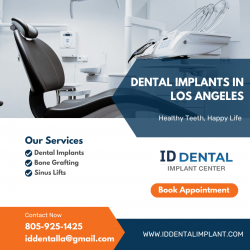 Dental Implants in Los Angeles | ID Dental & Implant Center