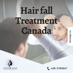 Hair fall Treatment Canada