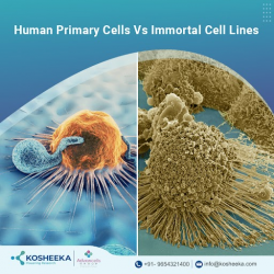 Human Primary Cells Vs Immortal Cell Lines