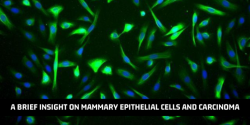 Mammary Epithelial Cells