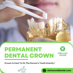 Permanent Crowns to Improve Your Teeth