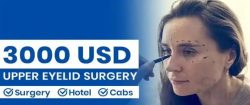 Explore Upper Eyelid Surgery Cost at CureIndia