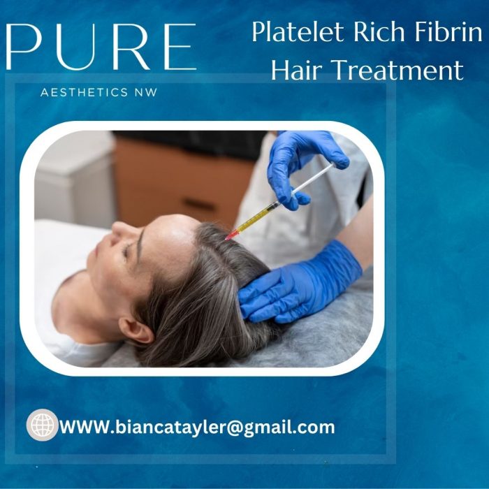 Platelet Rich Fibrin Hair Treatment