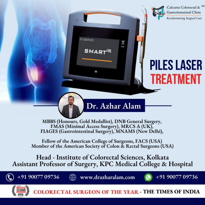 Piles Laser Treatment in Kolkata