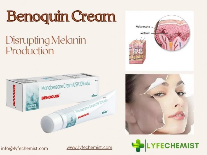 Benoquin Cream Disrupting Melanin Production