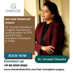 Get Appointment with the Doctor for Best Hair Transplant in Delhi