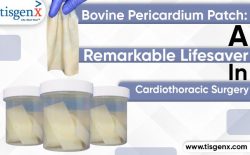 Bovine Pericardium Patch: A Remarkable Lifesaver in Cardiothoracic Surgery