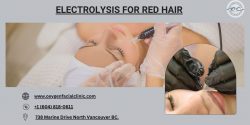 Permanent Solutions for Red Hair Removal: Electrolysis