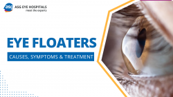 Eye Floaters: Causes, Symptoms and Treatment