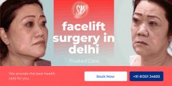 facelift surgery in Delhi