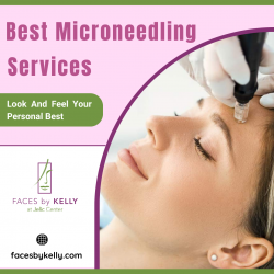 Microneedling Treatment for Your Face