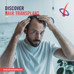 Discover Hair Transplant Treatment