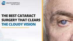 The Best Cataract Surgery That Clears the Cloudy Vision