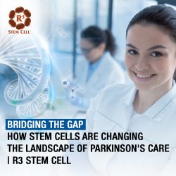 Bridging the Gap: How Stem Cells are Changing the Landscape of Parkinson’s Care | R3 Stem Cell