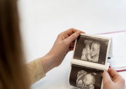 What Is 4d Sonography In Pregnancy?