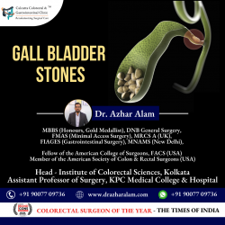 Advanced Laparoscopic Surgery for Gall bladder Stone