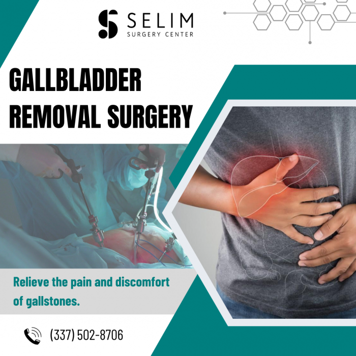 Best Gallbladder Surgery for Weight Loss