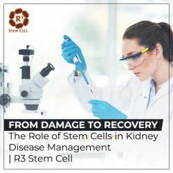 From Damage to Recovery: The Role of Stem Cells in Kidney Disease Management | R3 Stem Cell