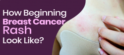 How Beginning Breast Cancer Rash Look Like?