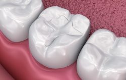 Restorative Dental Care IL