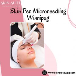 Skin Pen Microneedling Winnipeg