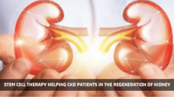 Kidney Stem Cell Therapy