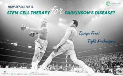 The available treatments for Parkinson’s disease