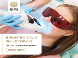 Teeth Whitening Services in Noblesville | SkyView Dental