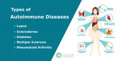 Common Autoimmune Diseases