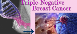What is Triple Negative Breast Cancer?