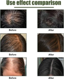 Revitalize Your Hair with FollicleRX: The Ultimate Solution