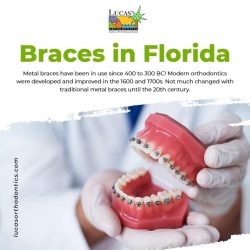 Unlock Your Best Smile with Lucas Orthodontics: Expert Braces in Florida!