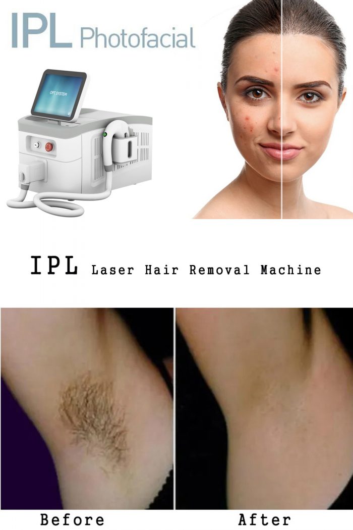 Professional IPL laser hair removal machine. The best IPL laser machine brand-BVLASER