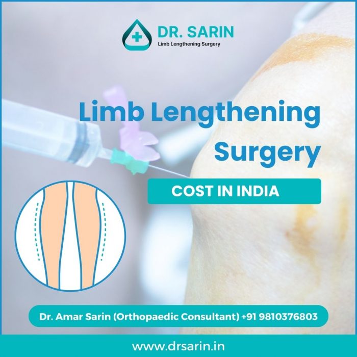 Limb Lengthening Surgery by Dr Sarin