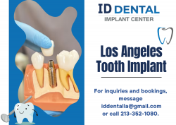 Smile Confidently Again with Los Angeles Tooth Implant Services