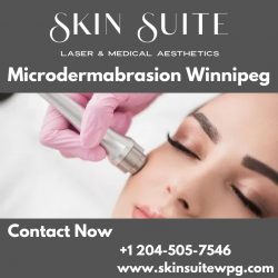 Microdermabrasion Winnipeg