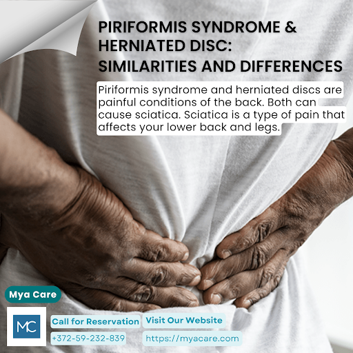 PIRIFORMIS SYNDROME & HERNIATED DISC SIMILARITIES AND DIFFERENCES