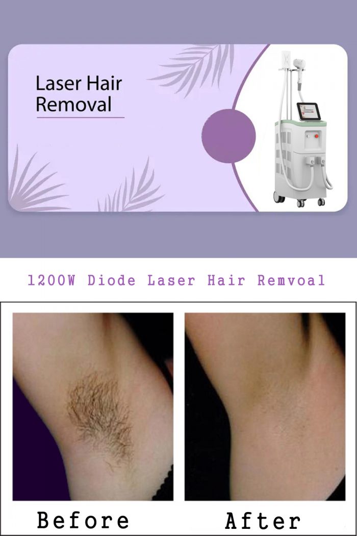 Diode laser hair removal machine supplier-BVLASER. The best brand laser hair removal machine. 12 ...