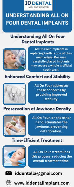 Understanding All On Four Dental Implants | ID Dental and Implant Center